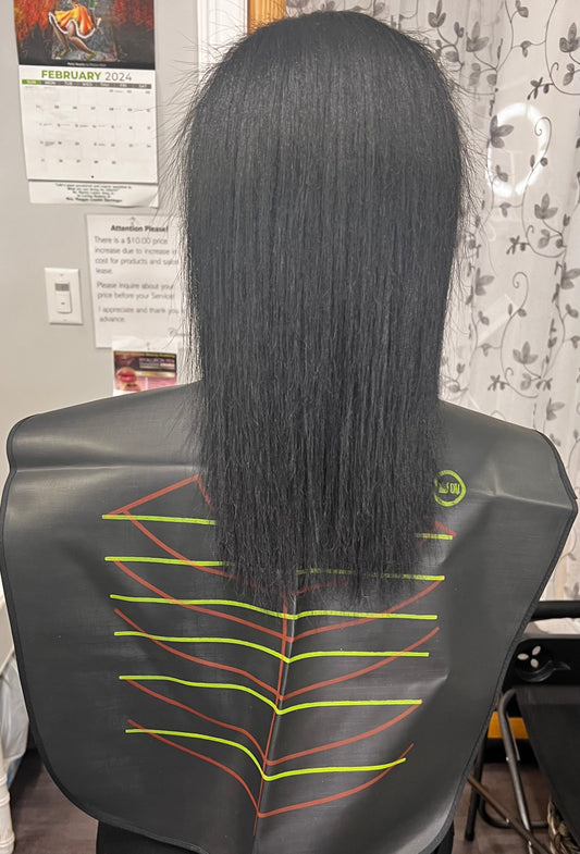 Hair loss - Personal experience