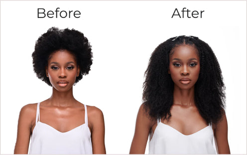 Stress and trauma - Hair loss