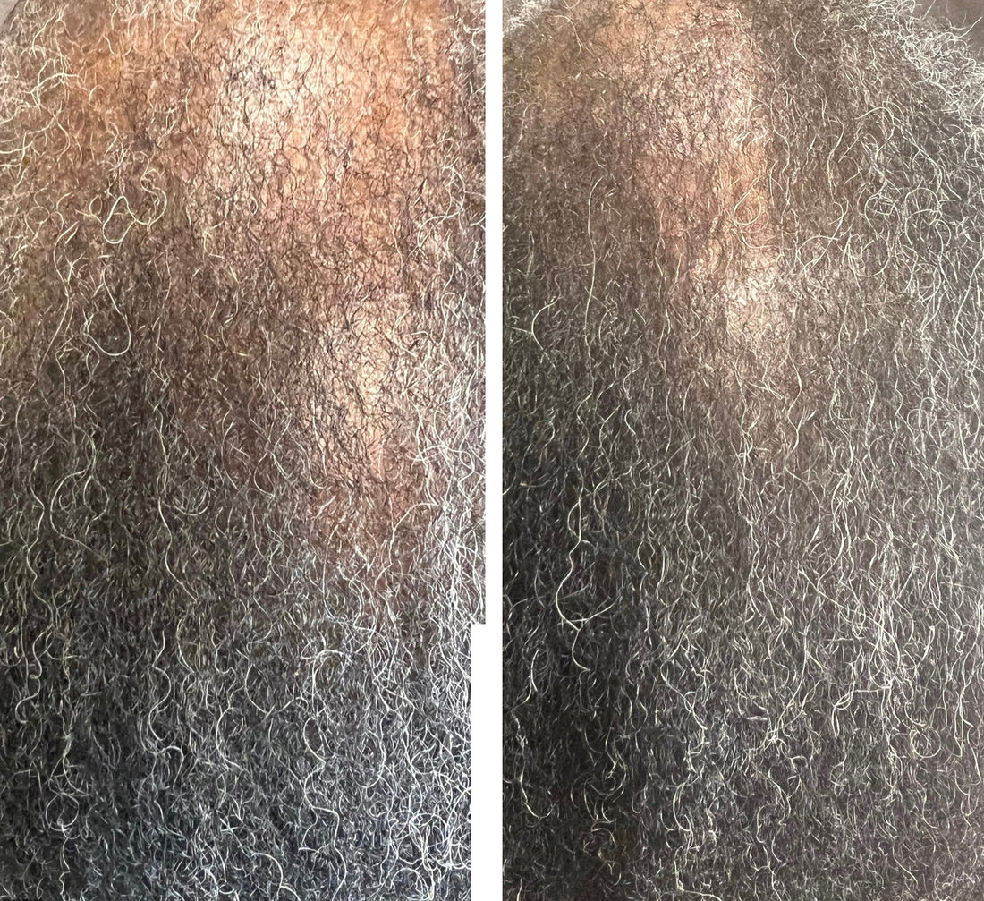 A Simple Daily Hair Care Routine for Thinning Hair